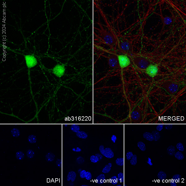 Immunocytochemistry/ Immunofluorescence - Anti-Parvalbumin antibody [RM1120] (ab316220), expandable thumbnail