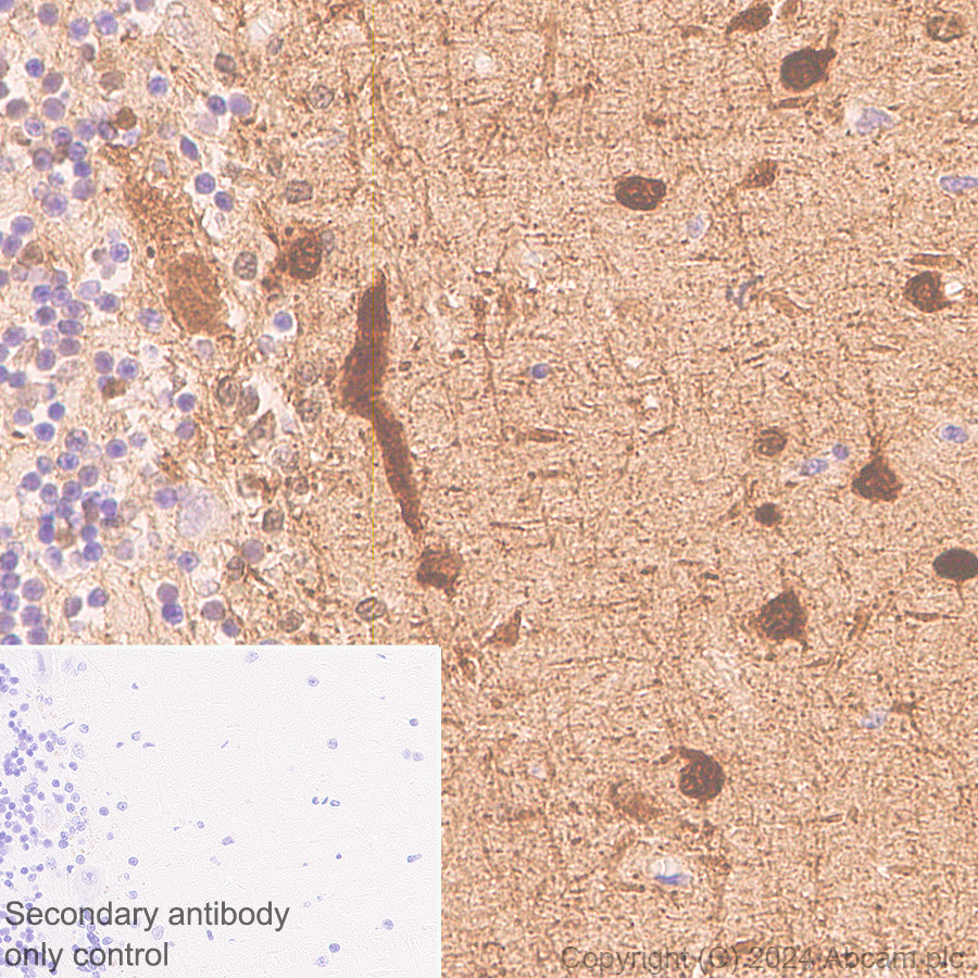 Immunohistochemistry (Formalin/PFA-fixed paraffin-embedded sections) - Anti-Parvalbumin antibody [RM1120] (ab316220), expandable thumbnail
