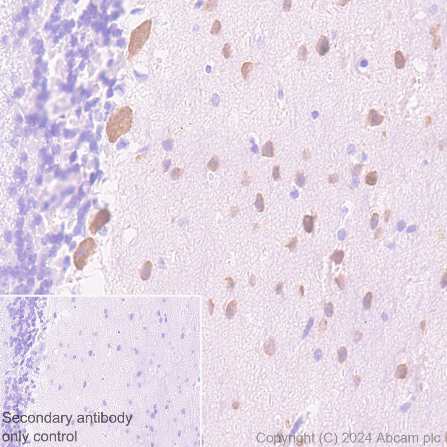 Immunohistochemistry (Formalin/PFA-fixed paraffin-embedded sections) - Anti-Parvalbumin antibody [RM1120] (AB316220), expandable thumbnail