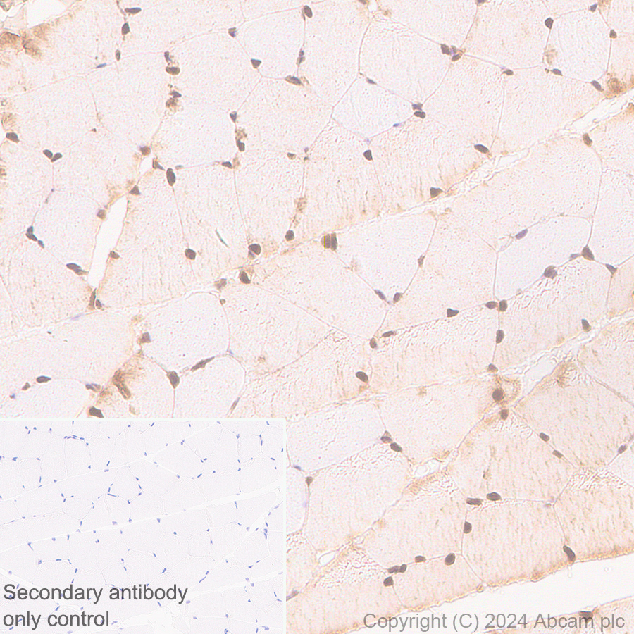 Immunohistochemistry (Formalin/PFA-fixed paraffin-embedded sections) - Anti-Parvalbumin antibody [RM1120] (AB316220), expandable thumbnail
