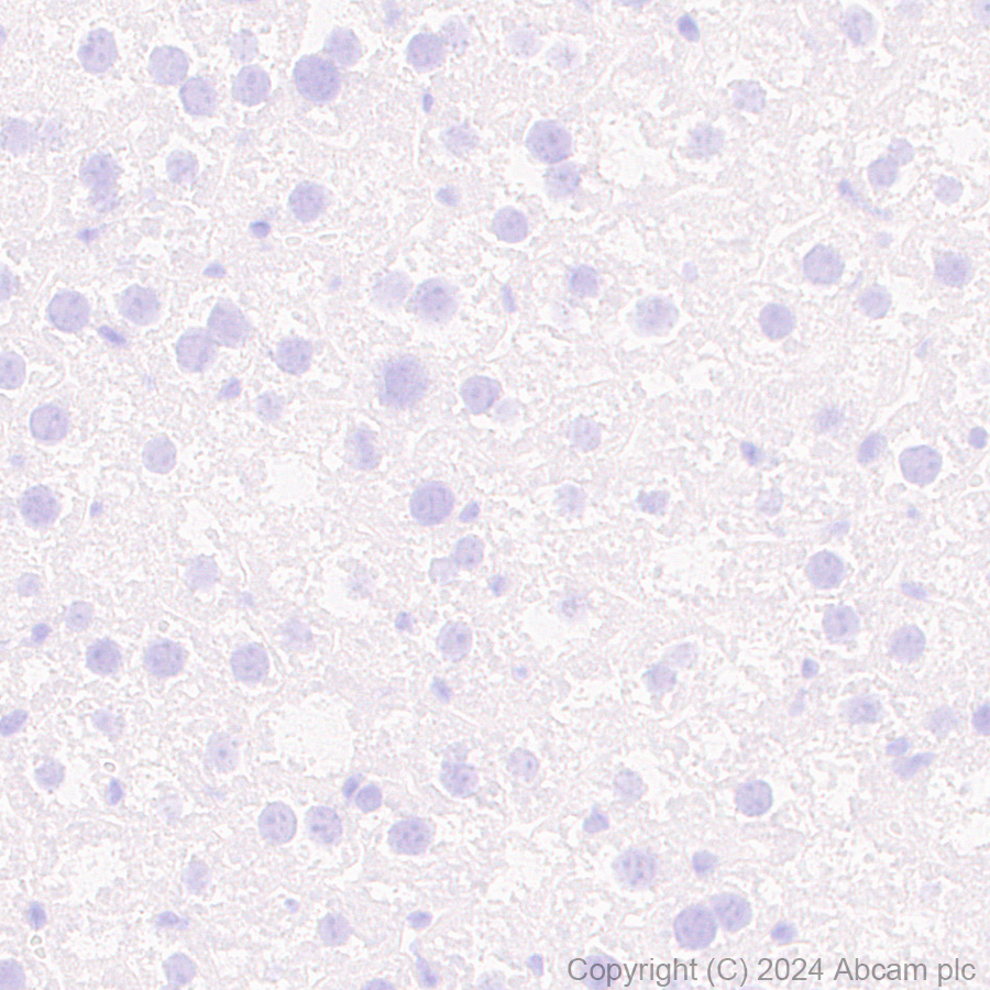 Immunohistochemistry (Formalin/PFA-fixed paraffin-embedded sections) - Anti-Parvalbumin antibody [RM1120] (AB316220), expandable thumbnail