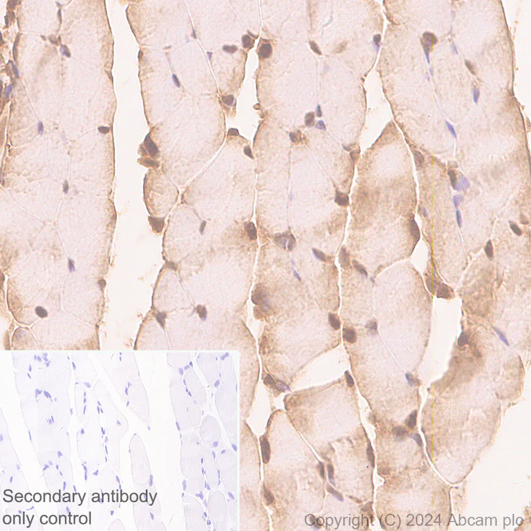 Immunohistochemistry (Formalin/PFA-fixed paraffin-embedded sections) - Anti-Parvalbumin antibody [RM1120] - BSA and Azide free (AB316221)