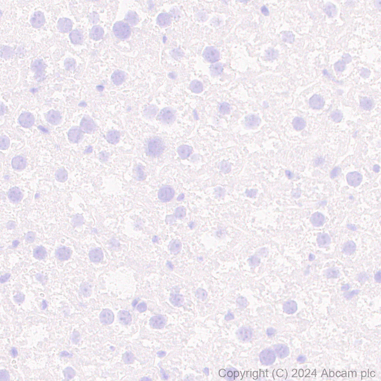 Immunohistochemistry (Formalin/PFA-fixed paraffin-embedded sections) - Anti-Parvalbumin antibody [RM1120] - BSA and Azide free (AB316221)