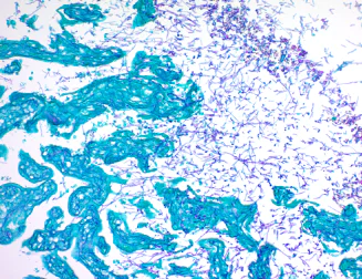 Immunohistochemistry (Formalin/PFA-fixed paraffin-embedded sections) - PAS Stain Kit (Fungus, Periodic Acid Schiff Stain) (AB245886)