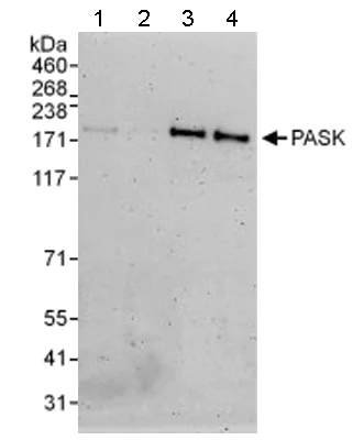 Western blot - Anti-PASK antibody (AB114988)