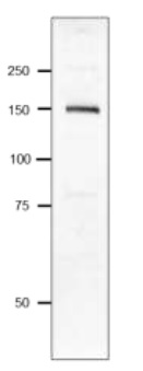 Western blot - Anti-Pasteurella multocida toxin antibody (AB243178), expandable thumbnail