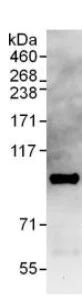 Immunoprecipitation - Anti-Pat1b antibody (AB124257)