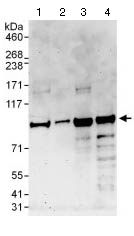 Western blot - Anti-Pat1b antibody (AB124257)