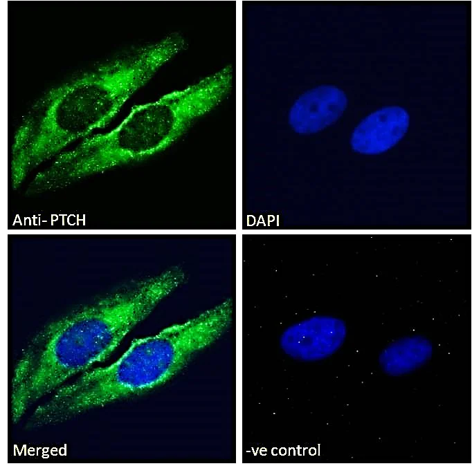 Immunocytochemistry/ Immunofluorescence - Anti-Patched / PTCH1 antibody (AB109096)