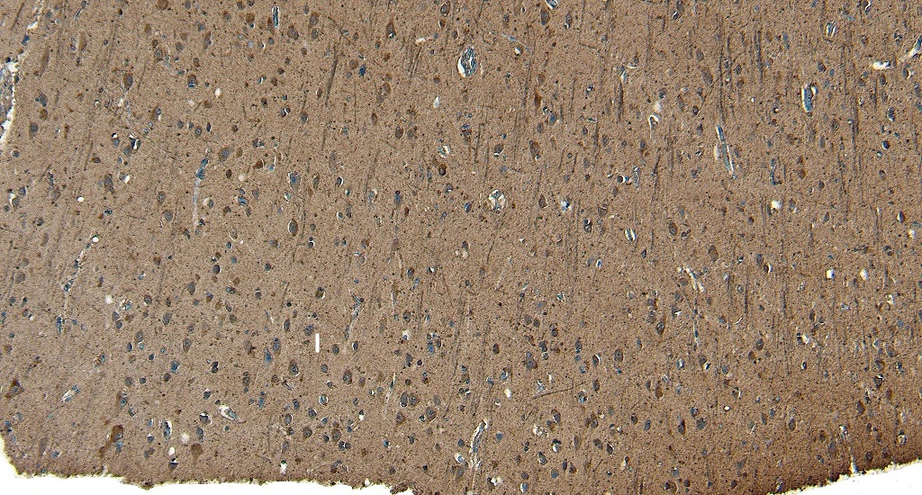 Immunohistochemistry (Formalin/PFA-fixed paraffin-embedded sections) - Anti-Patched / PTCH1 antibody (AB109096)