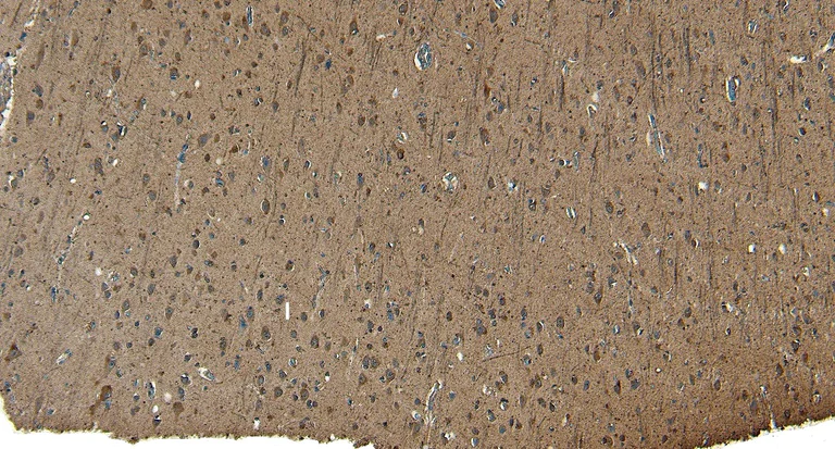 Immunohistochemistry (Formalin/PFA-fixed paraffin-embedded sections) - Anti-Patched / PTCH1 antibody (AB109096)