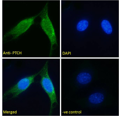 Immunocytochemistry - Anti-Patched / PTCH1 antibody (AB51983)