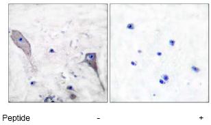 Immunohistochemistry (Formalin/PFA-fixed paraffin-embedded sections) - Anti-Patched / PTCH1 antibody (AB53715), expandable thumbnail