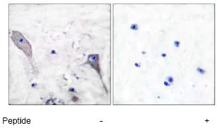 Immunohistochemistry (Formalin/PFA-fixed paraffin-embedded sections) - Anti-Patched / PTCH1 antibody (AB53715)