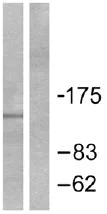 Western blot - Anti-Patched / PTCH1 antibody (AB53715)