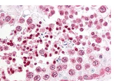 Immunohistochemistry (Formalin/PFA-fixed paraffin-embedded sections) - Anti-PATJ antibody (AB134784)