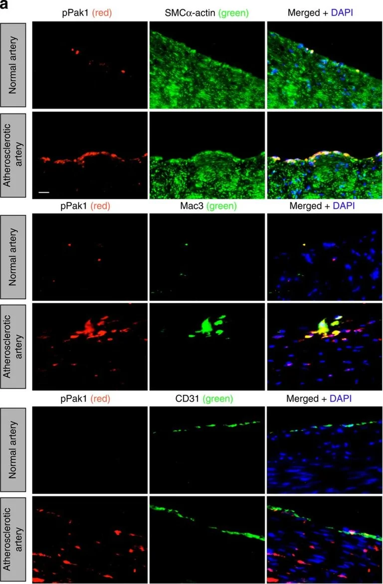 Immunocytochemistry/ Immunofluorescence - Anti-PATT1 antibody (AB106408)