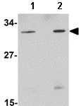 Western blot - Anti-PATT1 antibody (AB106408)