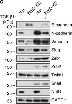 Western blot - Anti-PATT1 antibody (AB106408)