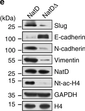 Western blot - Anti-PATT1 antibody (AB106408)