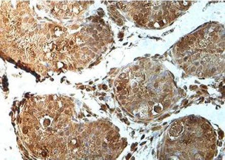 Immunohistochemistry (Formalin/PFA-fixed paraffin-embedded sections) - Anti-PAWP antibody (AB170115)