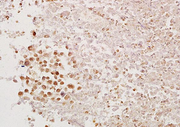 Immunohistochemistry (Formalin/PFA-fixed paraffin-embedded sections) - Anti-PAX1 antibody (AB203065)