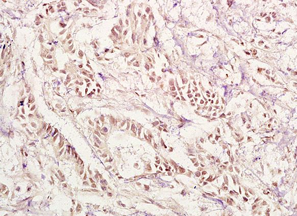 Immunohistochemistry (Formalin/PFA-fixed paraffin-embedded sections) - Anti-PAX1 antibody (AB203065)