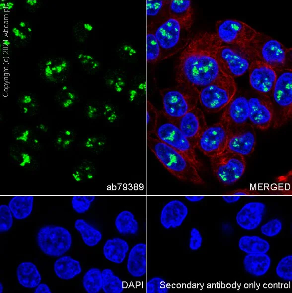 Immunocytochemistry/ Immunofluorescence - Anti-Pax2 antibody [EP3251] (AB79389)