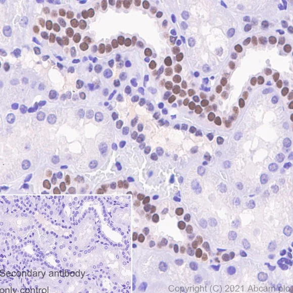 Immunohistochemistry (Formalin/PFA-fixed paraffin-embedded sections) - Anti-Pax2 antibody [EP3251] (AB79389)