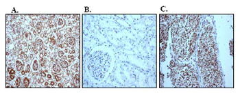 Immunohistochemistry (Formalin/PFA-fixed paraffin-embedded sections) - Anti-Pax2 antibody [EP3251] (AB79389)