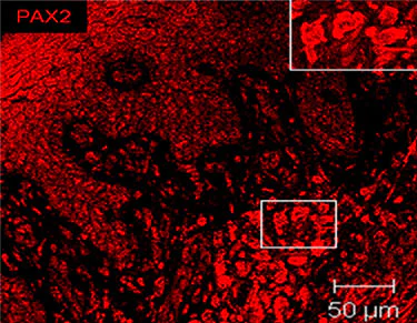 Immunohistochemistry (Formalin/PFA-fixed paraffin-embedded sections) - Anti-Pax2 antibody [EP3251] (AB79389)