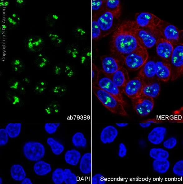 Immunocytochemistry/ Immunofluorescence - Anti-Pax2 antibody [EP3251] - BSA and Azide free (AB284763)