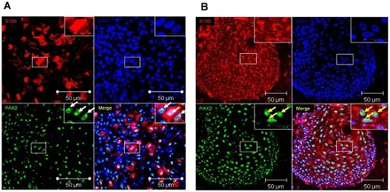 Immunocytochemistry/ Immunofluorescence - Anti-Pax2 antibody [EP3251] - BSA and Azide free (AB284763)