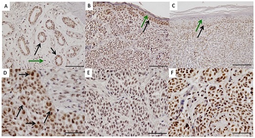 Immunohistochemistry (Formalin/PFA-fixed paraffin-embedded sections) - Anti-Pax2 antibody [EP3251] - BSA and Azide free (AB284763), expandable thumbnail