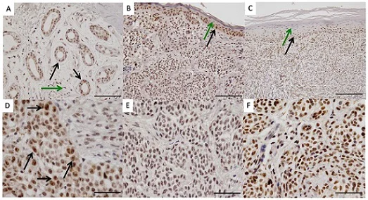 Immunohistochemistry (Formalin/PFA-fixed paraffin-embedded sections) - Anti-Pax2 antibody [EP3251] - BSA and Azide free (AB284763)