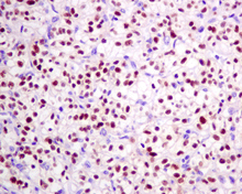 Immunohistochemistry (Formalin/PFA-fixed paraffin-embedded sections) - Anti-Pax2 antibody [EPR8586] (AB150391), expandable thumbnail