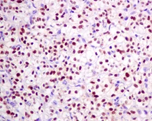 Immunohistochemistry (Formalin/PFA-fixed paraffin-embedded sections) - Anti-Pax2 antibody [EPR8586] (AB150391)