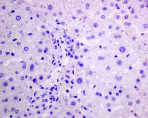 Immunohistochemistry (Formalin/PFA-fixed paraffin-embedded sections) - Anti-Pax2 antibody [EPR8586] (AB150391)