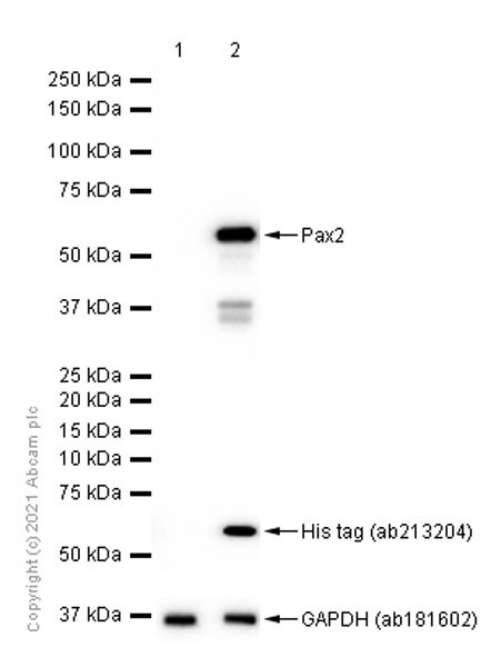 Western blot - Anti-Pax2 antibody [EPR8586] (AB150391), expandable thumbnail