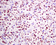 Immunohistochemistry (Formalin/PFA-fixed paraffin-embedded sections) - Anti-Pax2 antibody [EPR8586] - BSA and Azide free (AB232460), expandable thumbnail