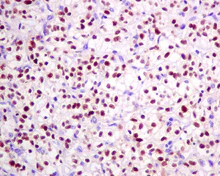 Immunohistochemistry (Formalin/PFA-fixed paraffin-embedded sections) - Anti-Pax2 antibody [EPR8586] - BSA and Azide free (AB232460)