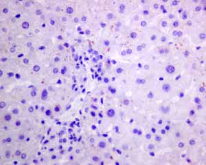 Immunohistochemistry (Formalin/PFA-fixed paraffin-embedded sections) - Anti-Pax2 antibody [EPR8586] - BSA and Azide free (ab232460), expandable thumbnail