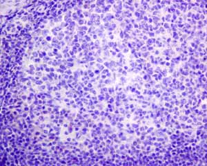 Immunohistochemistry (Formalin/PFA-fixed paraffin-embedded sections) - Anti-Pax2 antibody [EPR8586] - BSA and Azide free (AB232460)