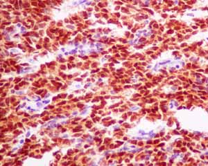 Immunohistochemistry (Formalin/PFA-fixed paraffin-embedded sections) - Anti-Pax2 antibody [EPR8586] - BSA and Azide free (AB232460), expandable thumbnail