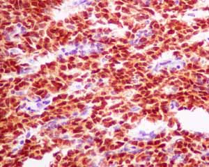 Immunohistochemistry (Formalin/PFA-fixed paraffin-embedded sections) - Anti-Pax2 antibody [EPR8586] - BSA and Azide free (AB232460)