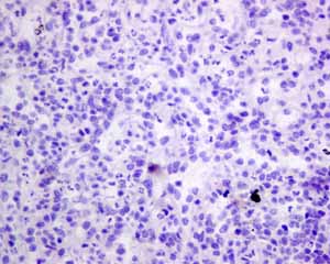 Immunohistochemistry (Formalin/PFA-fixed paraffin-embedded sections) - Anti-Pax2 antibody [EPR8586] - BSA and Azide free (ab232460), expandable thumbnail