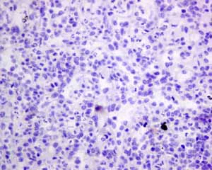 Immunohistochemistry (Formalin/PFA-fixed paraffin-embedded sections) - Anti-Pax2 antibody [EPR8586] - BSA and Azide free (AB232460)
