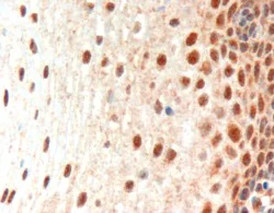 Immunohistochemistry (Formalin/PFA-fixed paraffin-embedded sections) - Anti-PAX3 antibody (AB15717)