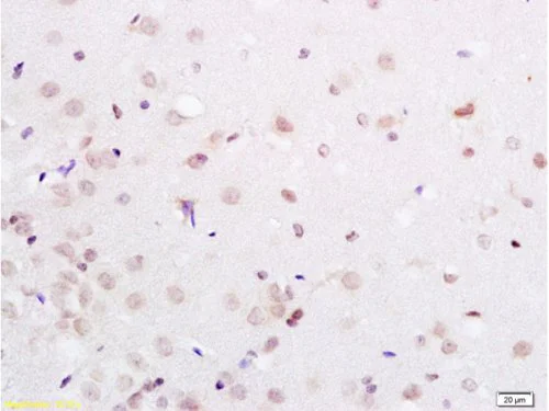 Immunohistochemistry (Formalin/PFA-fixed paraffin-embedded sections) - Anti-PAX3 antibody (AB216683)