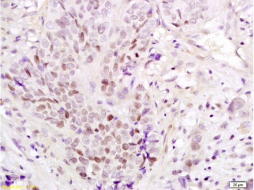 Immunohistochemistry (Formalin/PFA-fixed paraffin-embedded sections) - Anti-PAX3 antibody (AB216683)